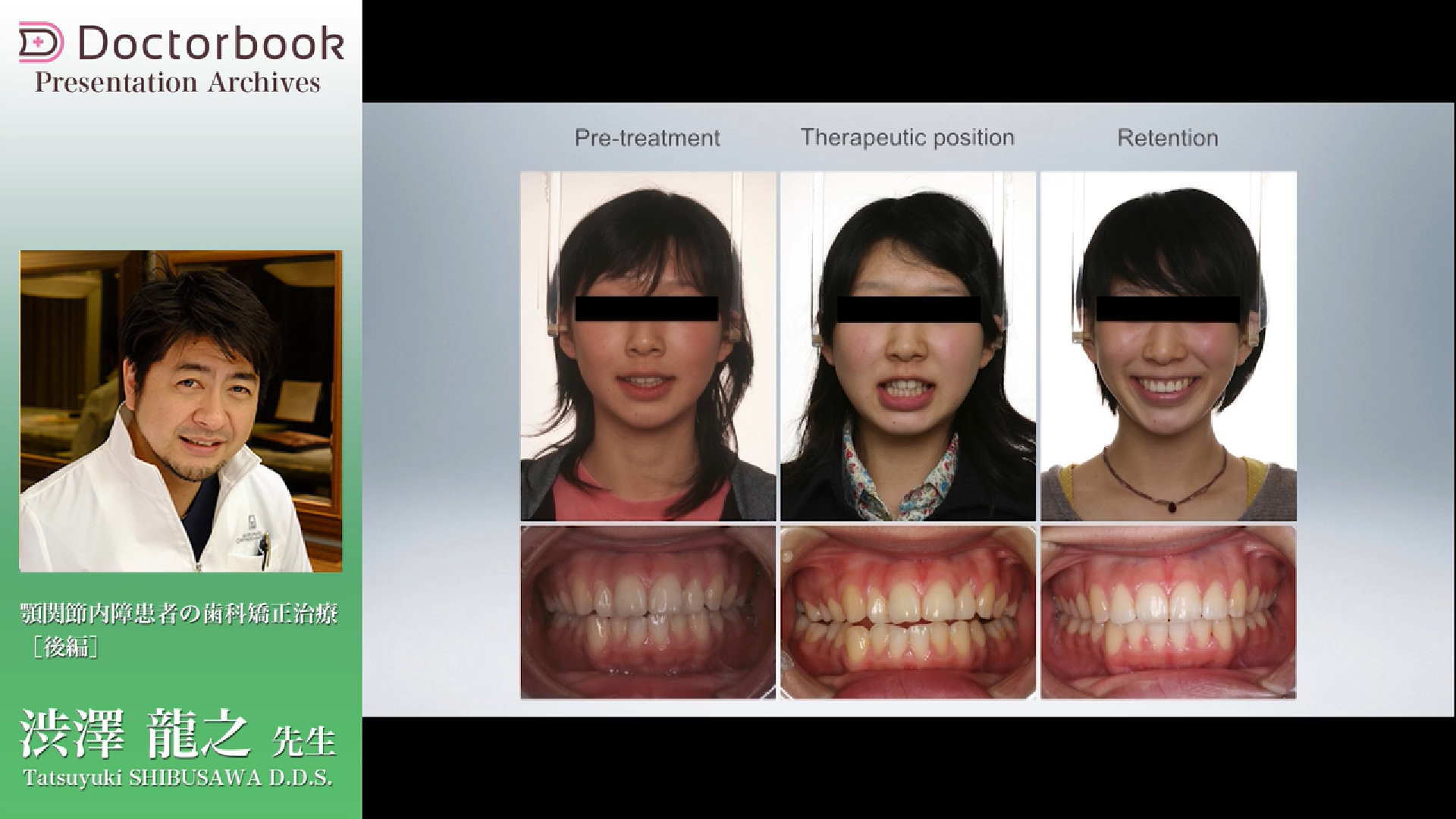 最新の矯正治療を知ろう～GPにも必要な矯正の知識～ | Doctorbook academy (ドクターブックアカデミー)